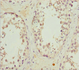 MRAS Antibody in Immunohistochemistry (Paraffin) (IHC (P))