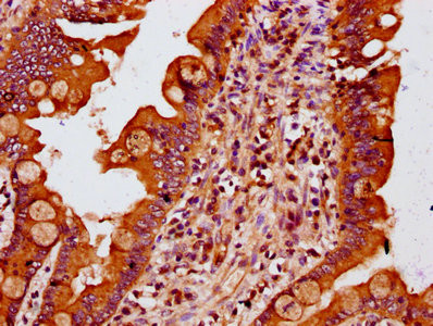 MTSS1 Antibody in Immunohistochemistry (Paraffin) (IHC (P))