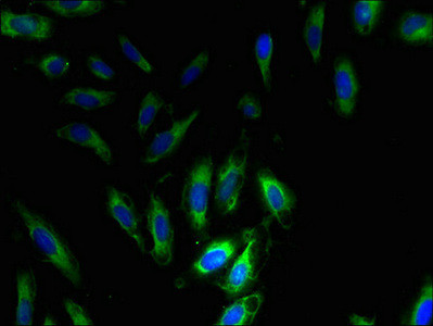 SNRPG Antibody in Immunocytochemistry (ICC/IF)