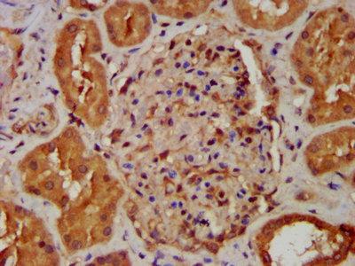 NDUFB8 Antibody in Immunohistochemistry (Paraffin) (IHC (P))