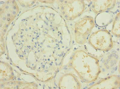PBLD Antibody in Immunohistochemistry (Paraffin) (IHC (P))