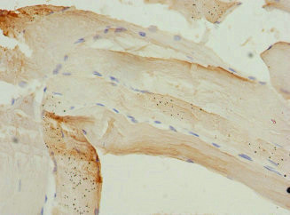 PIP5K1B Antibody in Immunohistochemistry (Paraffin) (IHC (P))