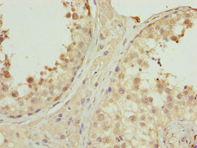 PNMA1 Antibody in Immunohistochemistry (Paraffin) (IHC (P))