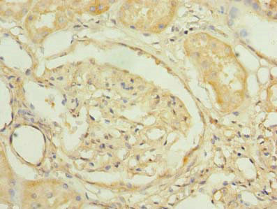 PNRC2 Antibody in Immunohistochemistry (Paraffin) (IHC (P))