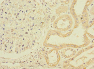 PPIAL4G Antibody in Immunohistochemistry (Paraffin) (IHC (P))