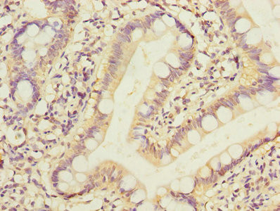PPM1D Antibody in Immunohistochemistry (Paraffin) (IHC (P))