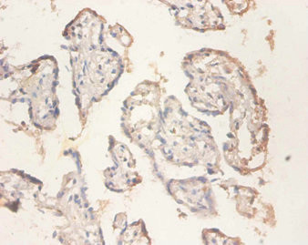 RPS11 Antibody in Immunohistochemistry (Paraffin) (IHC (P))
