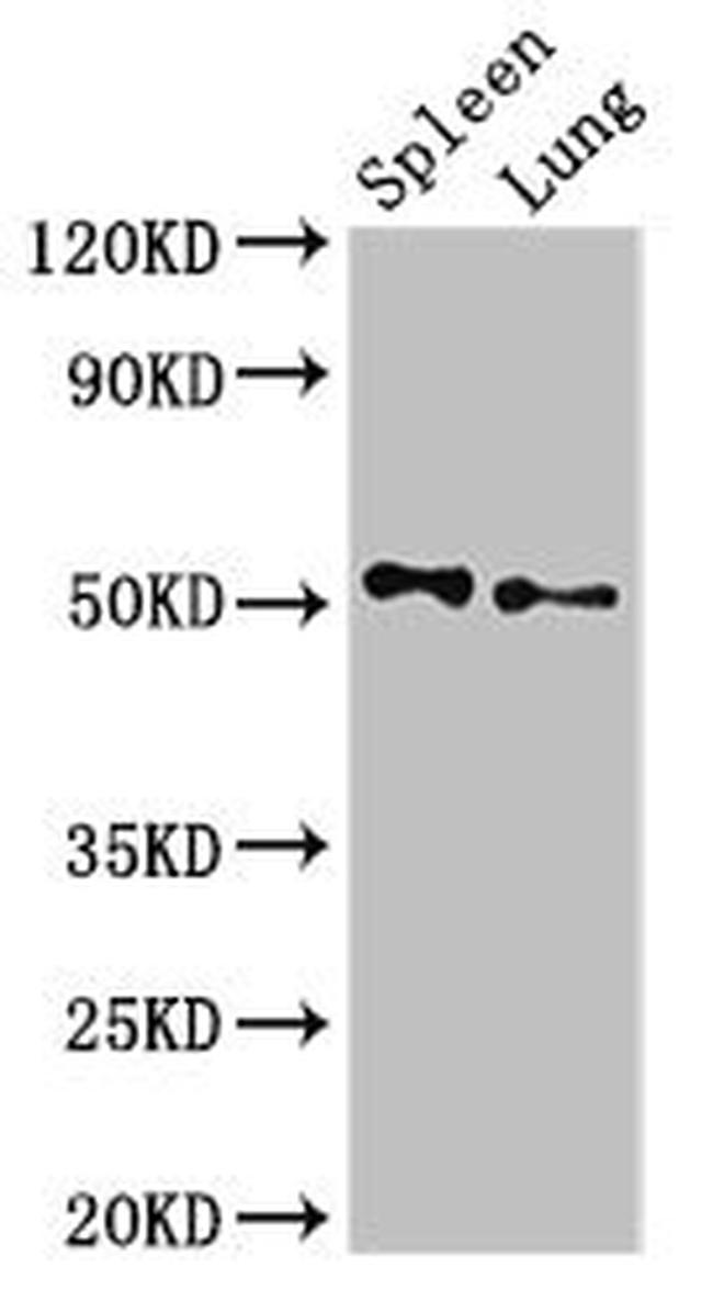 PSEN2 Antibody in Western Blot (WB)