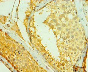 RAD1 Antibody in Immunohistochemistry (Paraffin) (IHC (P))
