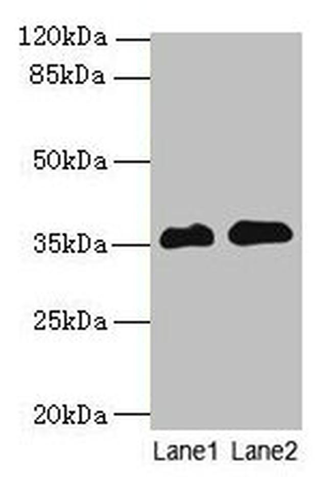 RFPL3 Antibody in Western Blot (WB)