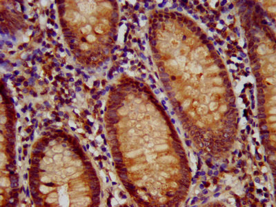 RFX1 Antibody in Immunohistochemistry (Paraffin) (IHC (P))