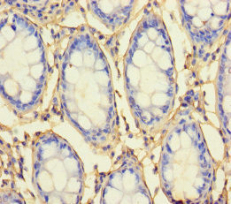 RHBDL2 Antibody in Immunohistochemistry (Paraffin) (IHC (P))