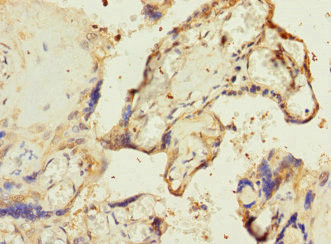 RPIA Antibody in Immunohistochemistry (Paraffin) (IHC (P))