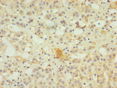 SERPINB8 Antibody in Immunohistochemistry (Paraffin) (IHC (P))
