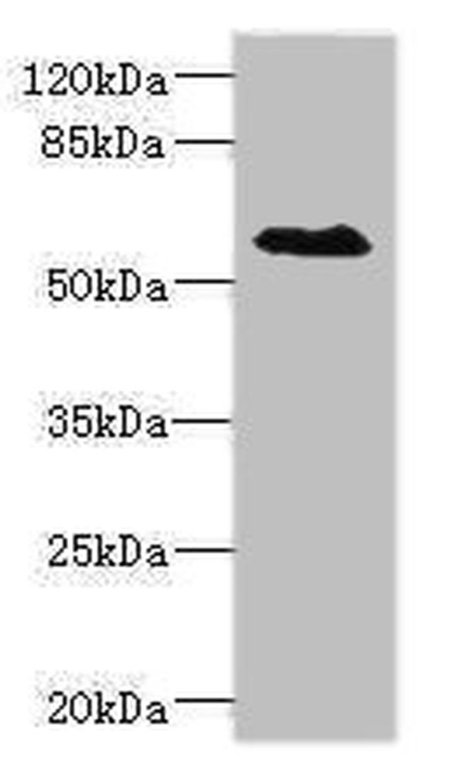 SLC1A7 Antibody in Western Blot (WB)