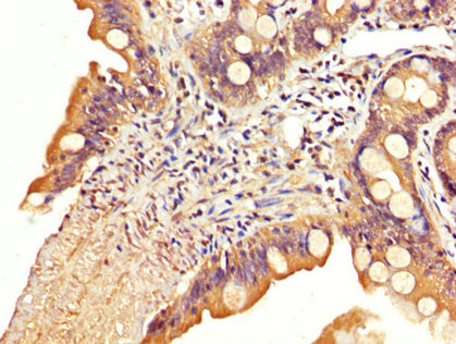 SLC22A23 Antibody in Immunohistochemistry (Paraffin) (IHC (P))
