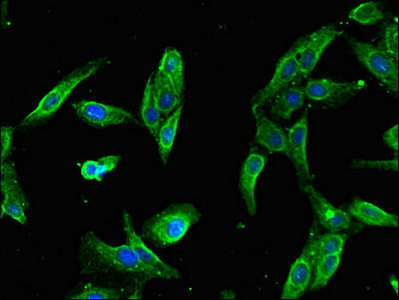 SLFN11 Antibody in Immunocytochemistry (ICC/IF)