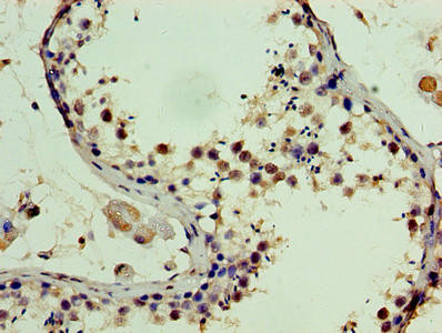 SSSCA1 Antibody in Immunohistochemistry (Paraffin) (IHC (P))