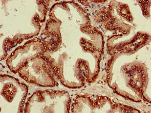ST8SIA5 Antibody in Immunohistochemistry (Paraffin) (IHC (P))