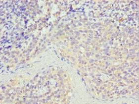 STK16 Antibody in Immunohistochemistry (Paraffin) (IHC (P))