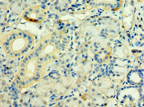 STXBP3 Antibody in Immunohistochemistry (Paraffin) (IHC (P))