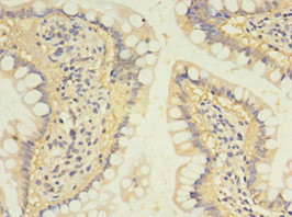 SULT1B1 Antibody in Immunohistochemistry (Paraffin) (IHC (P))