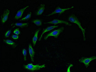 RPL27 Antibody in Immunocytochemistry (ICC/IF)