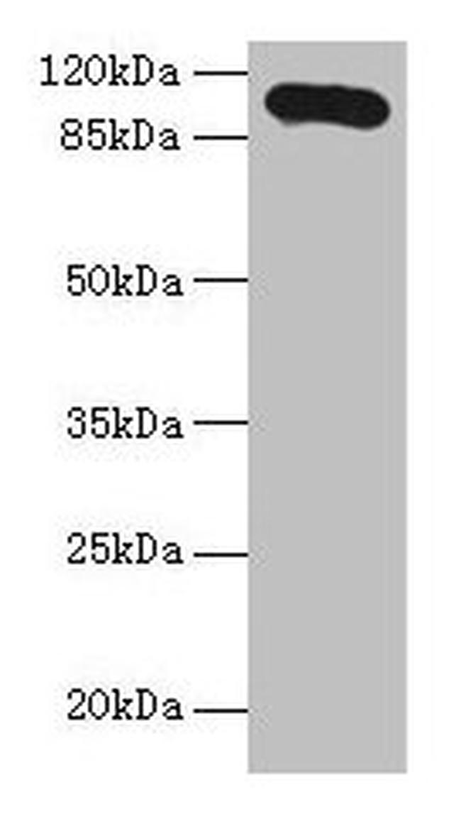 Thrombospondin 3 Antibody in Western Blot (WB)