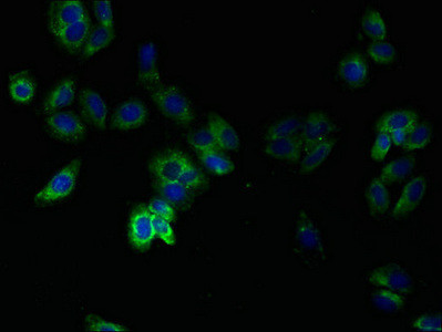 TMEM14B Antibody in Immunocytochemistry (ICC/IF)
