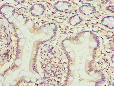 TMEM154 Antibody in Immunohistochemistry (Paraffin) (IHC (P))