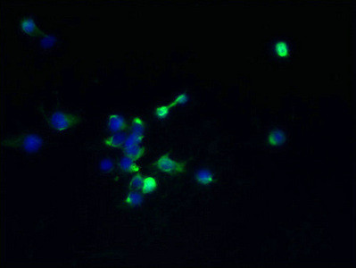 TMEM174 Antibody in Immunocytochemistry (ICC/IF)