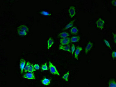 T176B Antibody in Immunocytochemistry (ICC/IF)