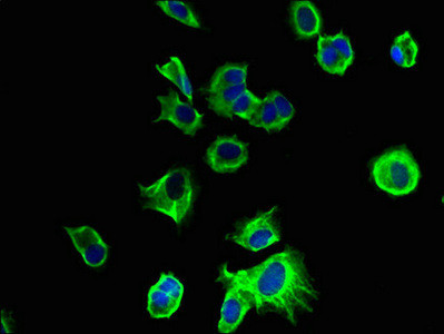 TMEM186 Antibody in Immunocytochemistry (ICC/IF)