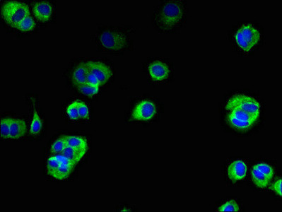 TMEM222 Antibody in Immunocytochemistry (ICC/IF)