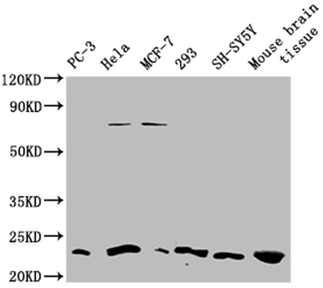 TMEM65 Antibody in Western Blot (WB)