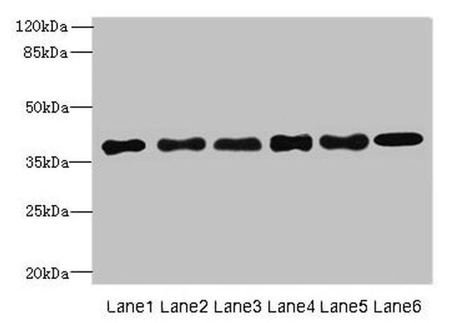 TMEM68 Antibody in Western Blot (WB)