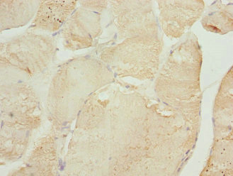 TNNI2 Antibody in Immunohistochemistry (Paraffin) (IHC (P))