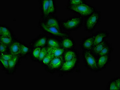 TPD52L2 Antibody in Immunocytochemistry (ICC/IF)