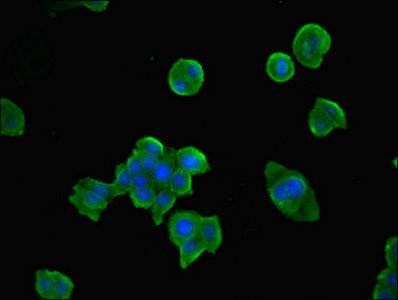 TPK1 Antibody in Immunocytochemistry (ICC/IF)