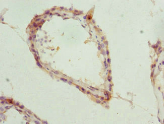 TPP2 Antibody in Immunohistochemistry (Paraffin) (IHC (P))