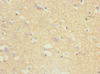 TPPP Antibody in Immunohistochemistry (Paraffin) (IHC (P))