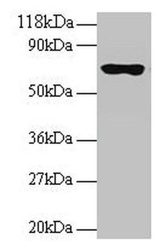 RPL15 Antibody in Western Blot (WB)