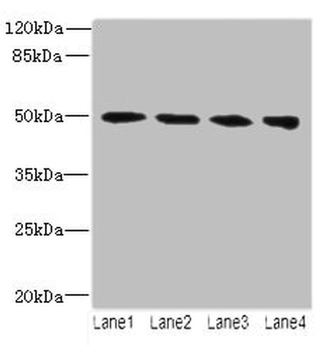 TUBB2A Antibody in Western Blot (WB)
