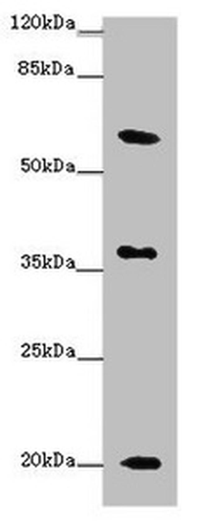 XG Antibody in Western Blot (WB)