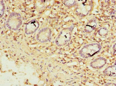 ZNF19 Antibody in Immunohistochemistry (Paraffin) (IHC (P))