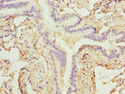 ZNF212 Antibody in Immunohistochemistry (Paraffin) (IHC (P))