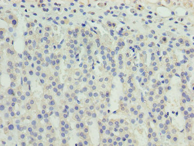 ZNF215 Antibody in Immunohistochemistry (Paraffin) (IHC (P))
