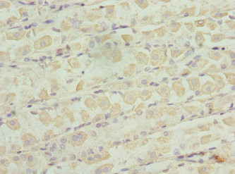 ZNF324 Antibody in Immunohistochemistry (Paraffin) (IHC (P))