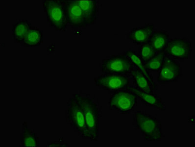 ZNF529 Antibody in Immunocytochemistry (ICC/IF)