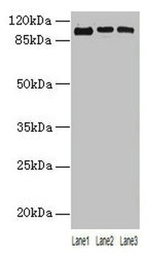 ZNF546 Antibody in Western Blot (WB)